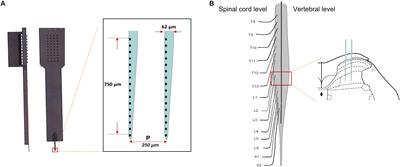 Electroacupuncture-Induced Muscular Inflammatory Pain Relief Was Associated With Activation of Low-Threshold Mechanoreceptor Neurons and Inhibition of Wide Dynamic Range Neurons in Spinal Dorsal Horn